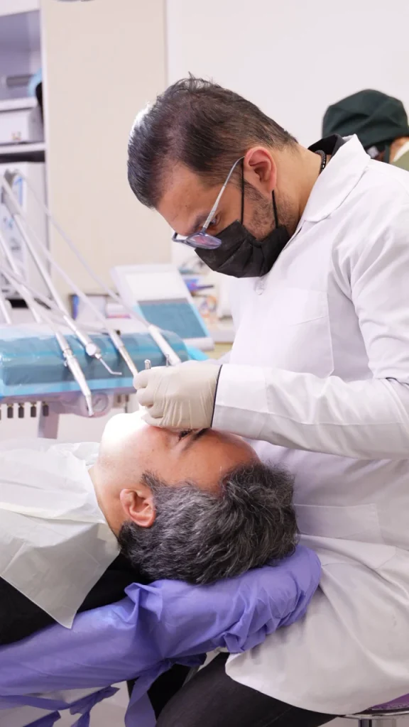 عصب کشی دندان نیش ۳